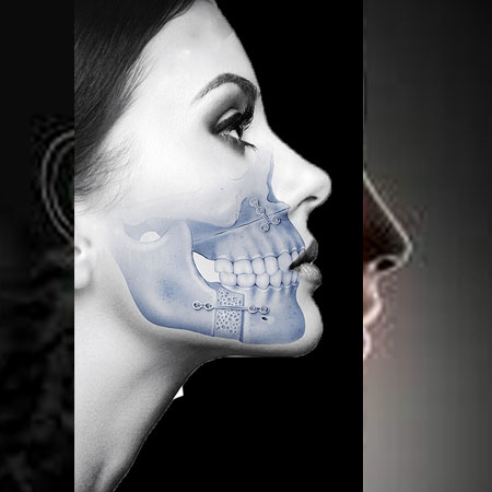 maxillofacial prosthetics